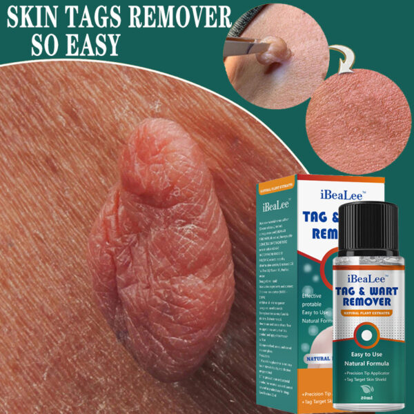 Moisturizing Facial Wart Remover