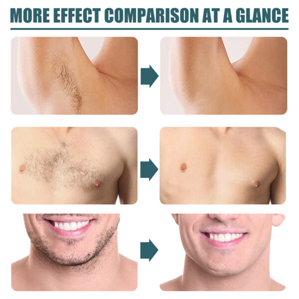 Men's Hair Removal Cream Is Clean And Gentle - Image 5